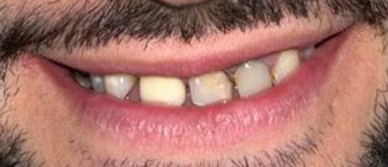 Caso de éxito - Clínica Dental Raquel Arribas