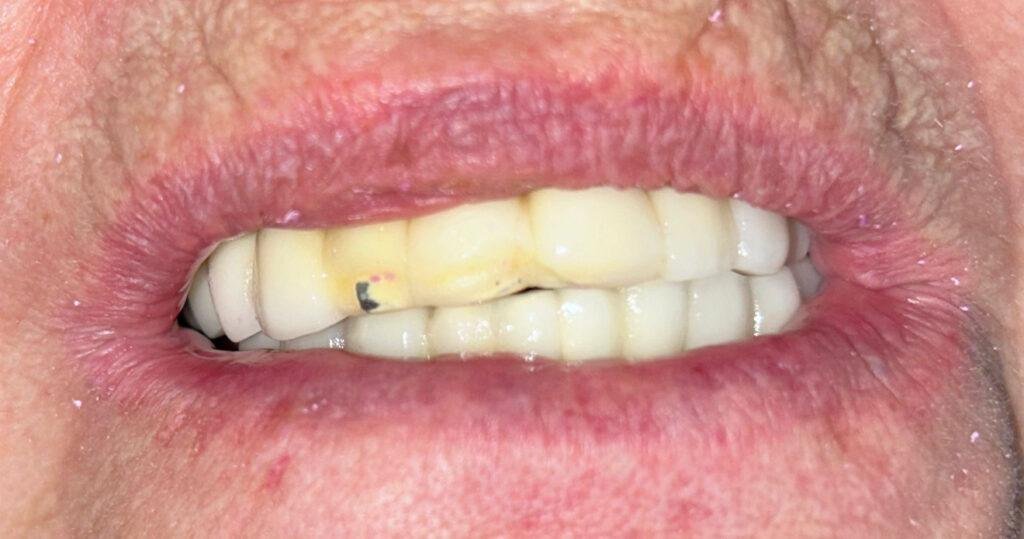 Caso de éxito - Clínica Dental Raquel Arribas