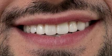 Caso de éxito - Clínica Dental Raquel Arribas