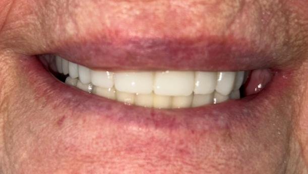 Caso de éxito - Clínica Dental Raquel Arribas
