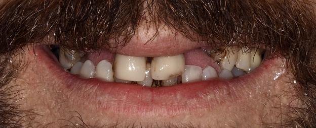 Caso de éxito - Clínica Dental Raquel Arribas