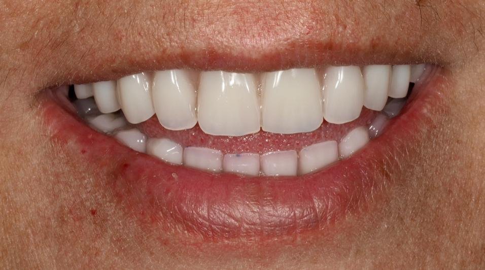 Caso de éxito - Clínica Dental Raquel Arribas