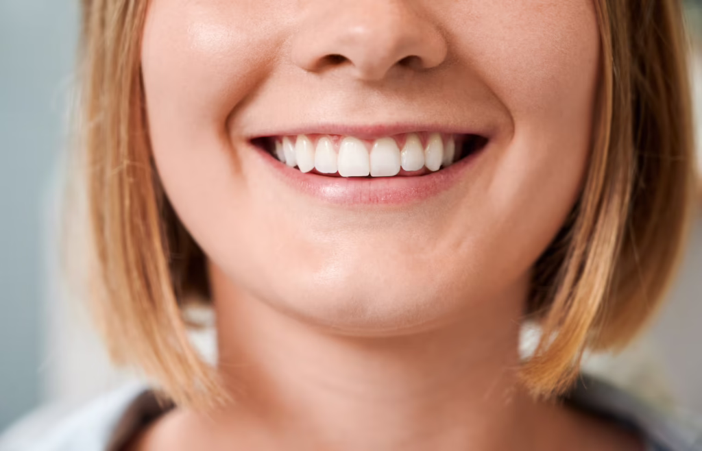 Alineación de los dientes