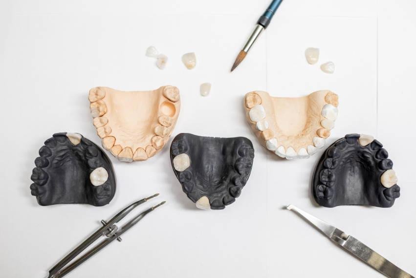 Pròtesis Dentals